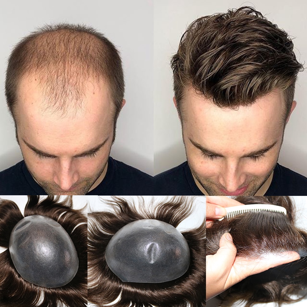 remy hair replacement