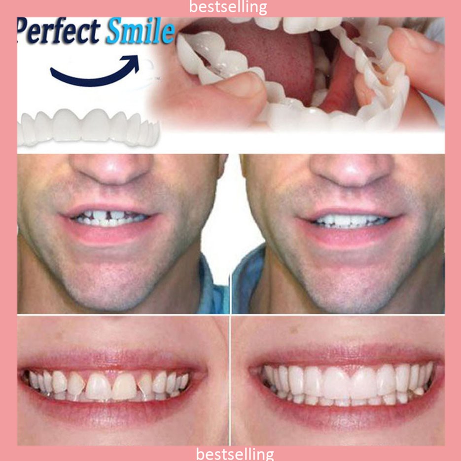 Perfect Smile Instant Teeth Cosmetic Veneers Comfort Cover Snap On