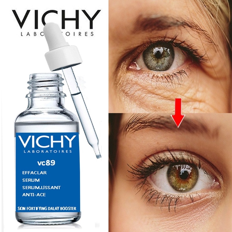 vichy vit c serum