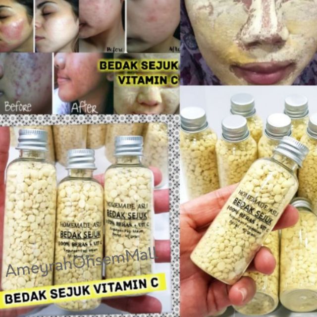 Bedak Sejuk Vitamin C Bedak Rawatan Jerawat Resdung Whitening M Malaysia