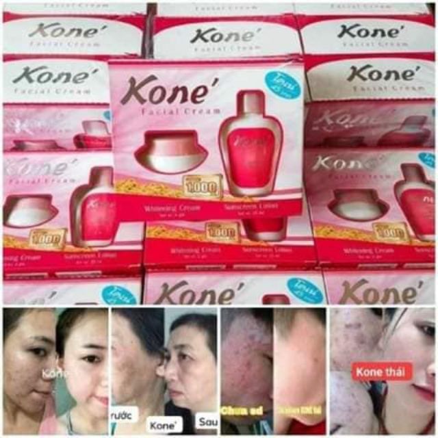 Kone Facial Cream Viral Berkesan Ready Stock Kone Facial Cream 2in1 Whitening Cream Suncreen Lotion Original Shopee Malaysia