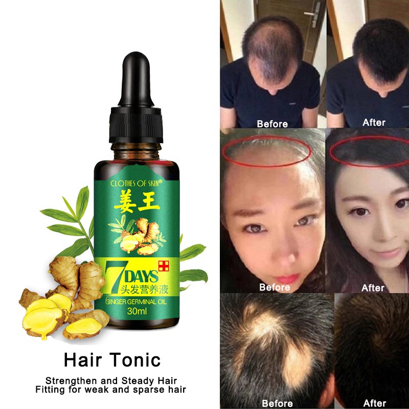 7 Days Ginger Germinal Oil Liquid Hair Tonic Hair Health Care Nourishing  Nutrient Herbal Formula Serum for Hair Growth | Shopee Malaysia
