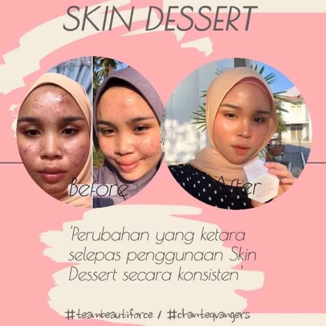 Dessert founder skin Skintimate US