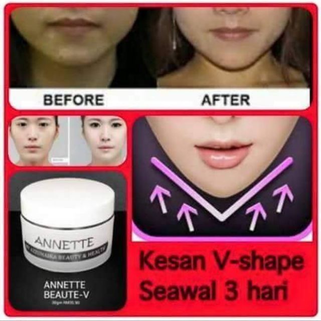 ANNETTE V Shape Face - Double Chin Reducer  Shopee Malaysia