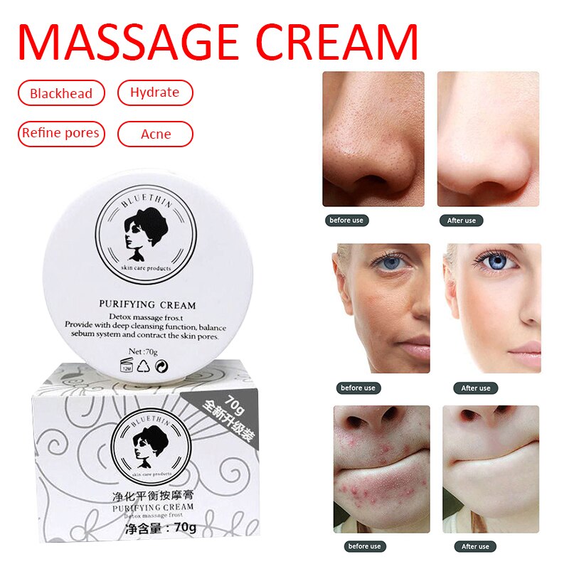 Purify Cream Facial Skin Detox Care Whitening Deep Cleansing Dark Spot Acne Treatment Brightening Shrink Pores Face Care Tslm2 Shopee Malaysia