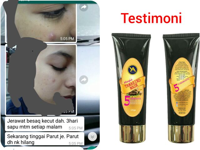 Ubat Jerawat Skincare Magic Tamarind Mask Mtm Jerawat Parut Berlubang Pores Scar Mask Skincare Parut Hitam Shopee Malaysia