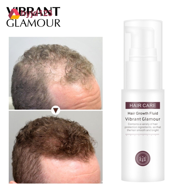 Vibrant Glamour Hair Growth Essence Spray Preventing Baldness