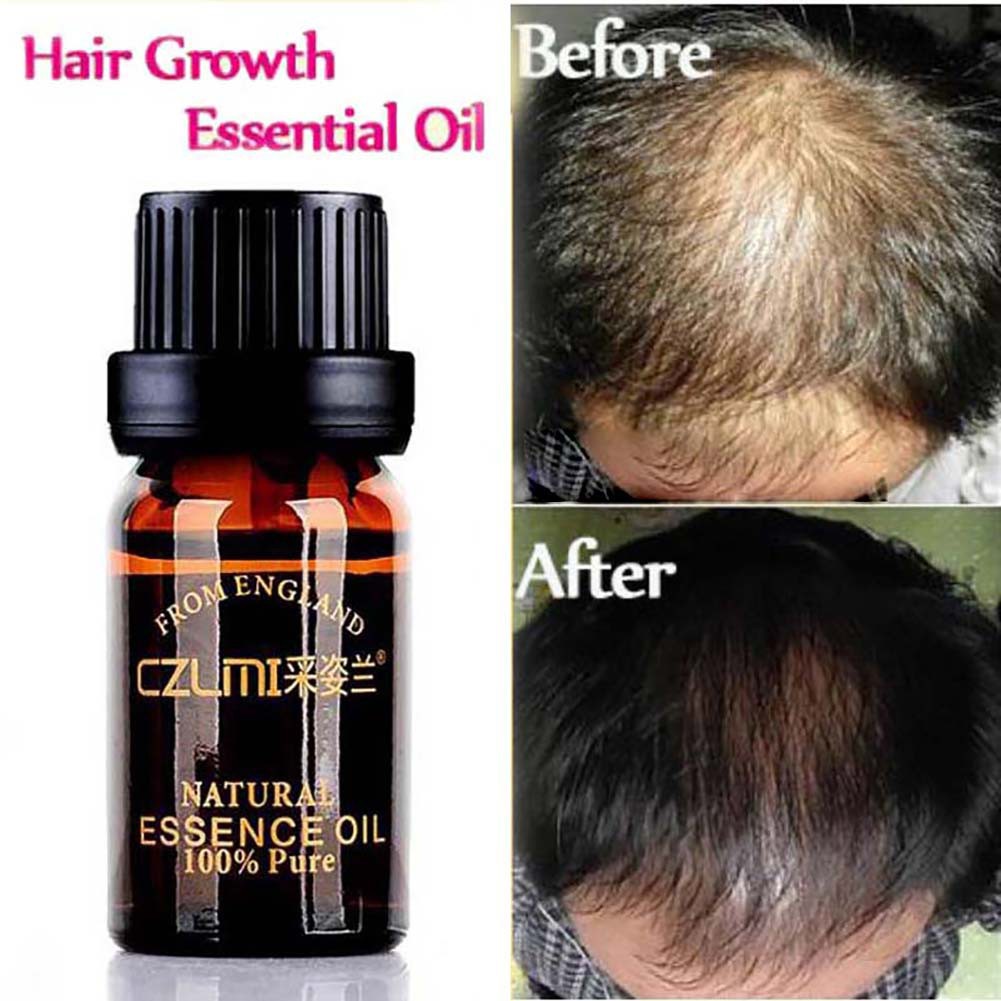 Natural Herbal Hair Loss Tonic Fast Hair Growth Hair Care Shopee