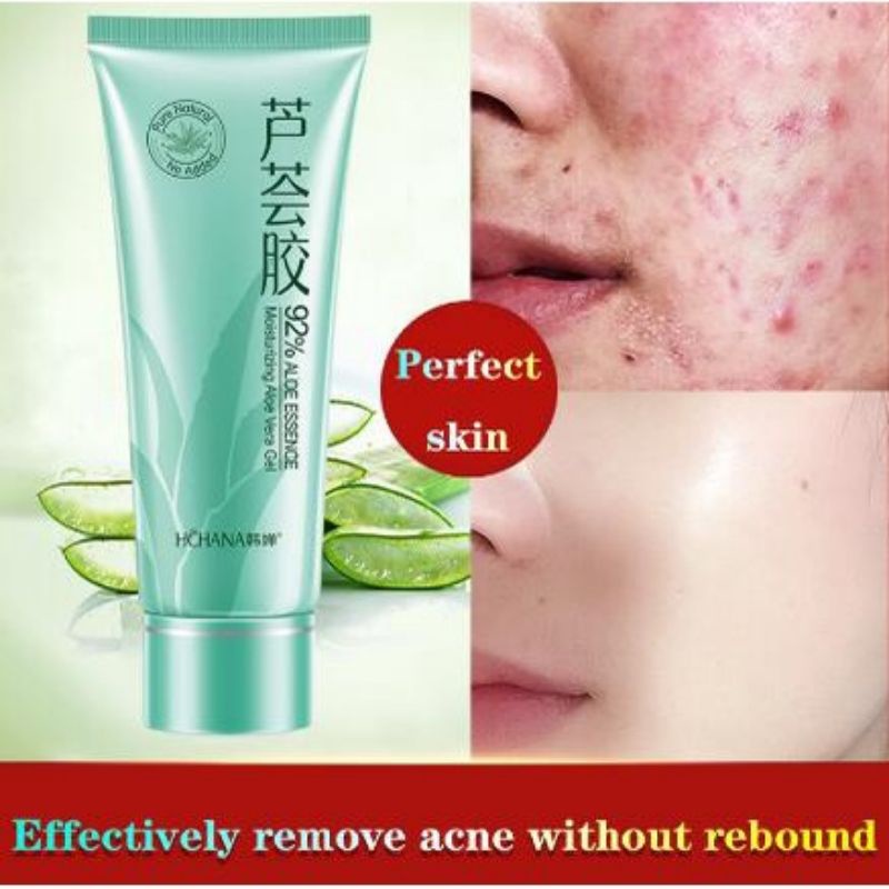 Pimples Soothing Moisturizing Aloe Vera Gel Hydrating, Soothing Moisturizer Shopee Malaysia