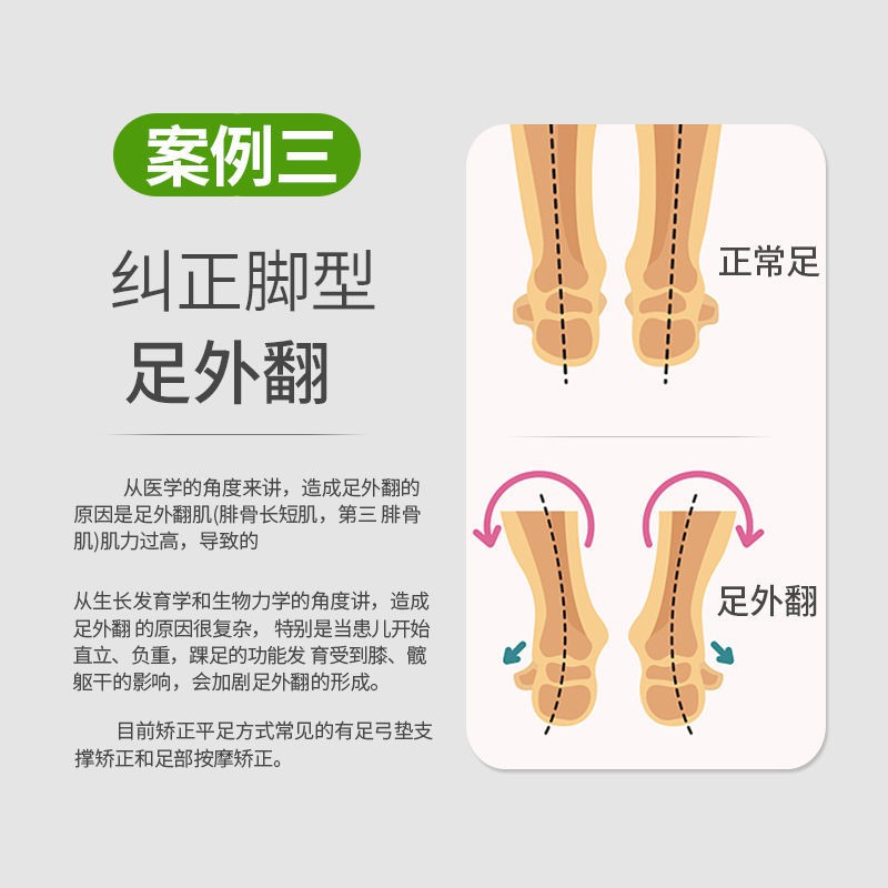 Flat Feet Orthopedic Insoles Orthopedic Devices Flat Feet 扁平足矫正鞋垫矫形器平底足 纠正神器高足弓支撑偏平足成人足弓垫henxinuu My Shopee Malaysia