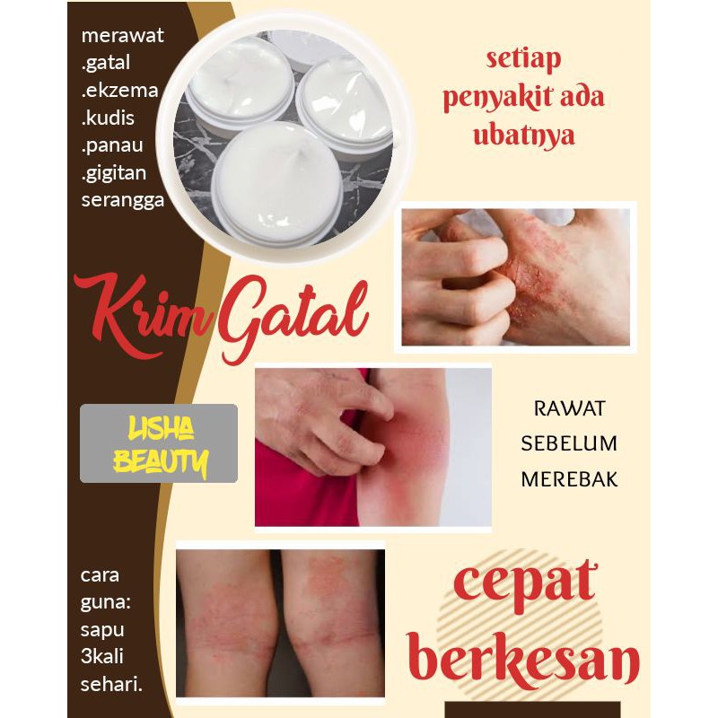 Krim Gatal Ubat Gatal Gatal Hilang Kulit Sekata Parut Hilang Gatal Tiada