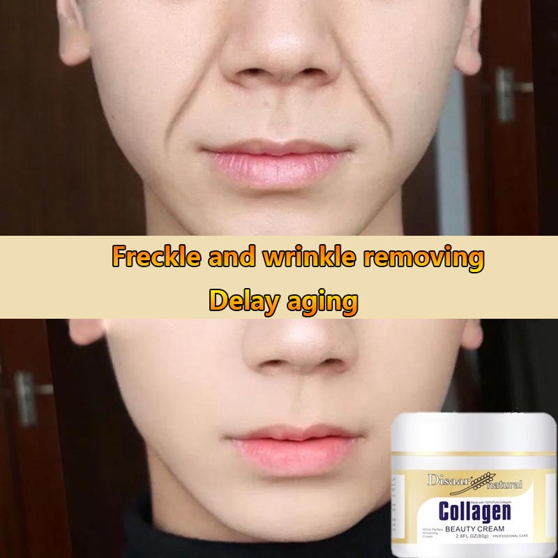 Collagen Cream Face Cream Lighten Dark Spots Repair Damaged Skin