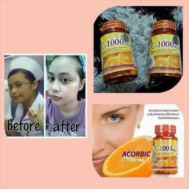 Harga Terendah Vitamin C 30biji Shopee Malaysia