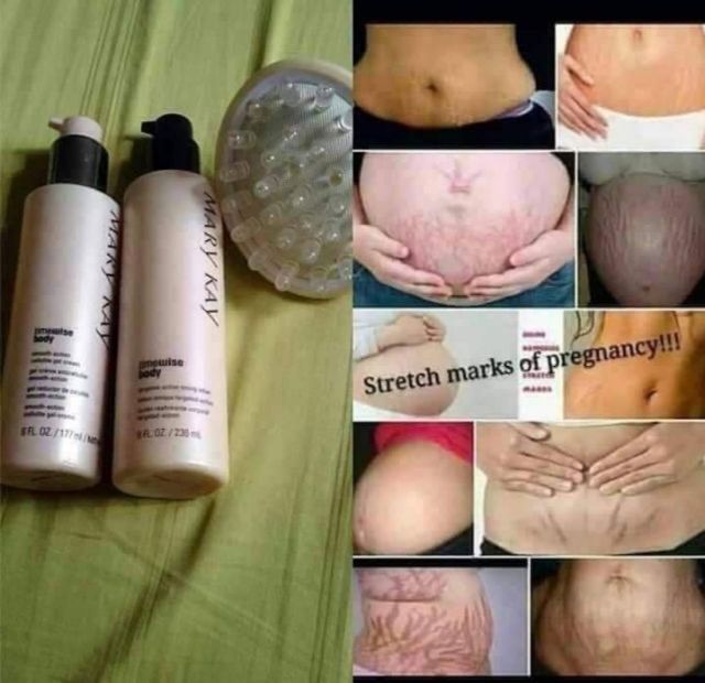 mary kay toning lotion for stretch marks