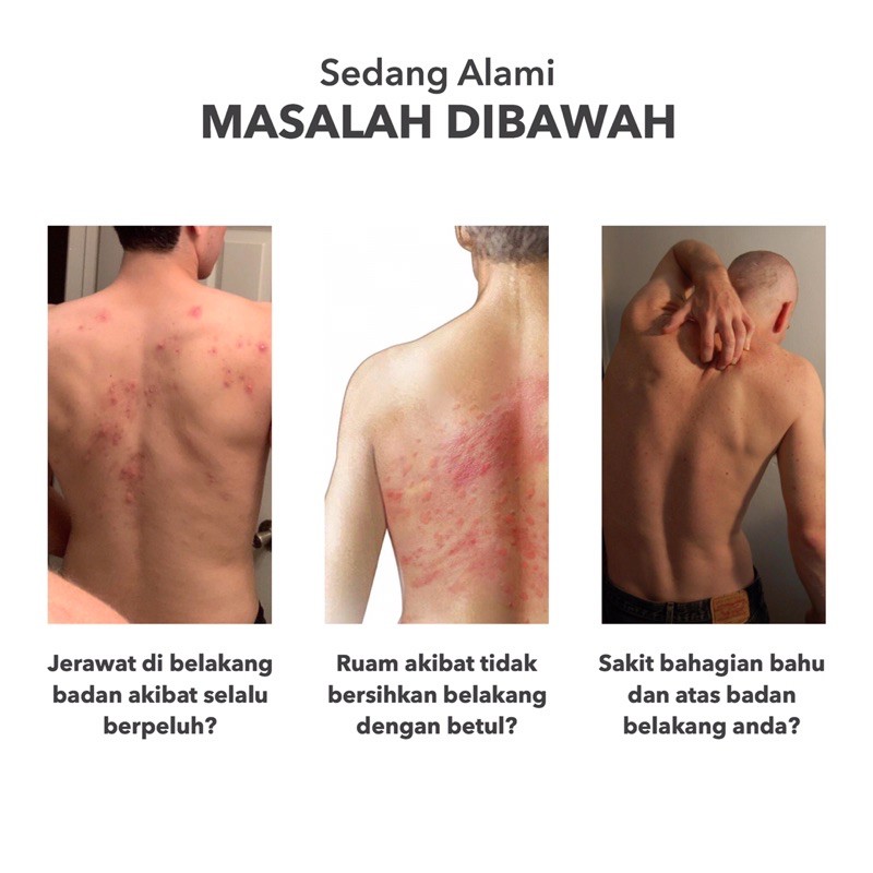 Readystock Tuala Mandi Silikon Gosok Belakang Badan Untuk Masalah Jerawat Lenguh Ruam Di Bahagian Belakang Badan Shopee Malaysia