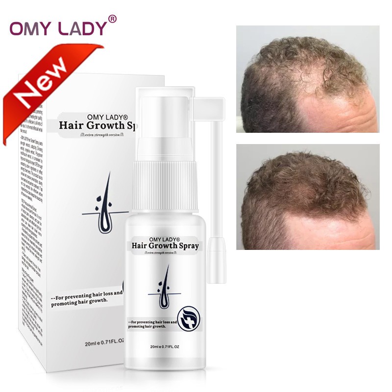 Omy Lady Anti Hair Loss Hair Growth Spray Essential Oil Hair Loss