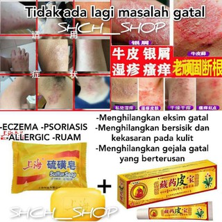 Psoriasis Eczema Cream Antifungal Antibacterial Itchy Cream Ubat Gatal Kurap Krim Ezcema Ekzema Ringworm Red Rashes å»¯ Shopee Malaysia