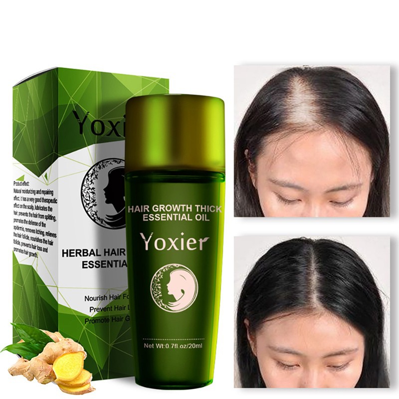 Exo ღ Yoxier Hair Growth Thicken Essential Oil Nourishing Hair