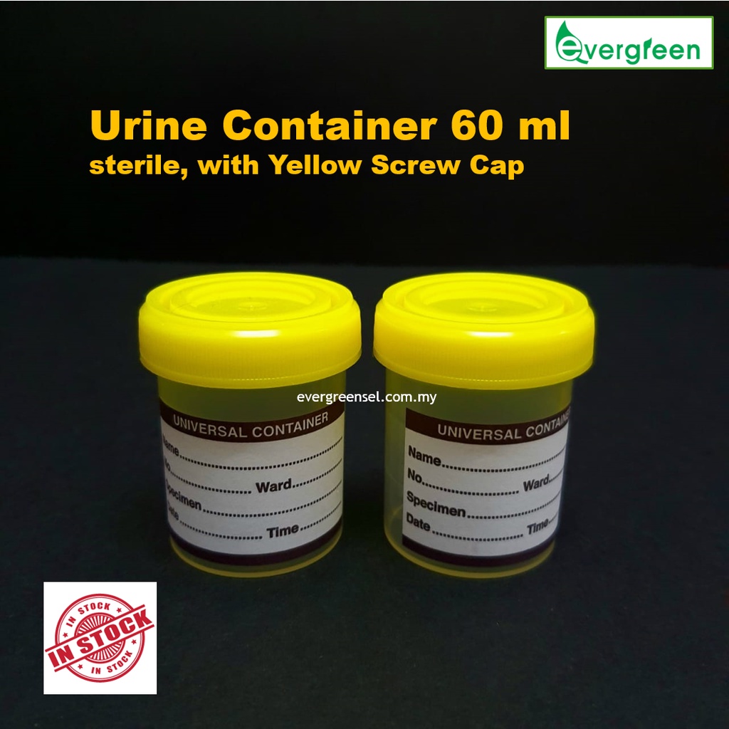 Specimen Container (Urine Container / Universal Container ) 60 ml with