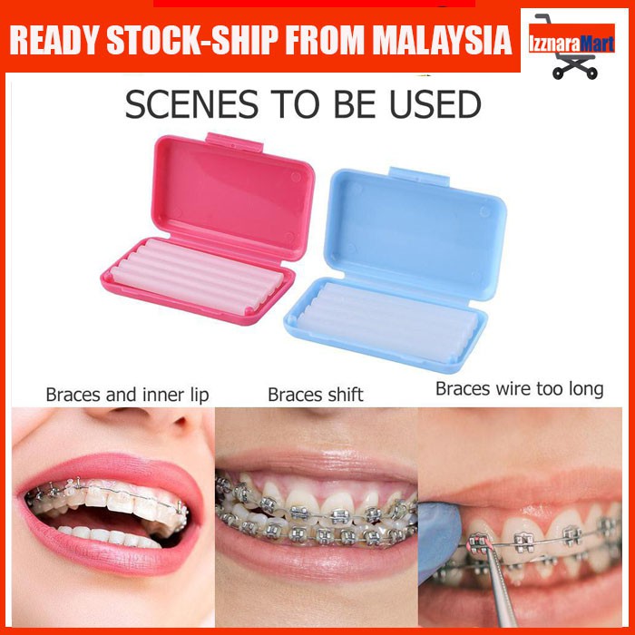 Ready Stock Orthodontic Braces Ortho Relief Wax Dental Wax Shopee Malaysia