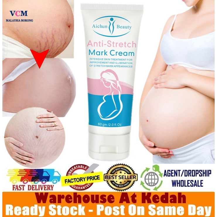 aichun stretch mark cream