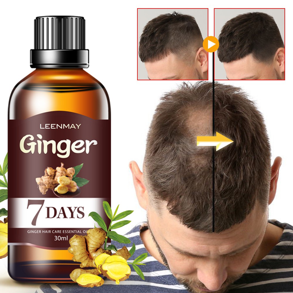 Fast Hair Growth Faster Grow Hair Regrowth For Men Women Pure Natural Hair Loss Products Pilatory Treatment Hair Oil Shopee Malaysia