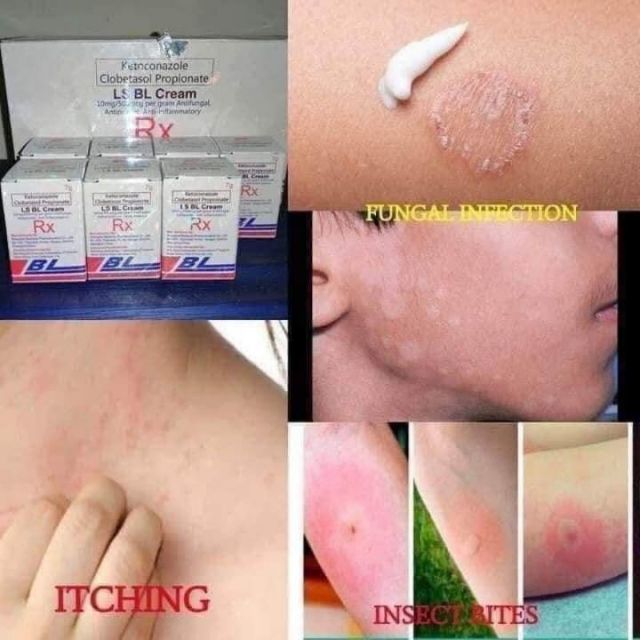 bl cream for diaper rash