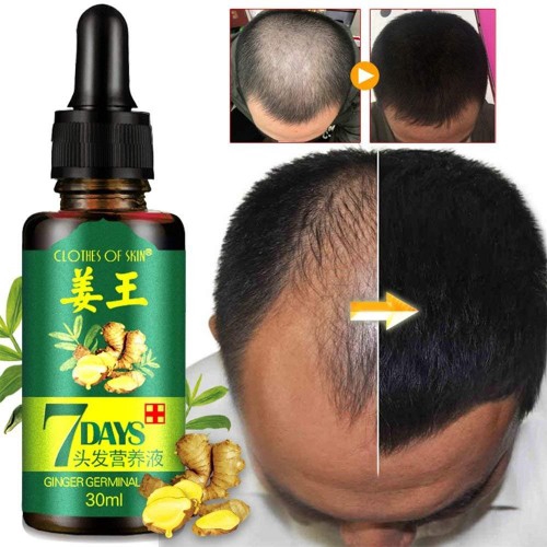 Ginger Germinal Essential Oil Hair Growth Loss Treatment For Men