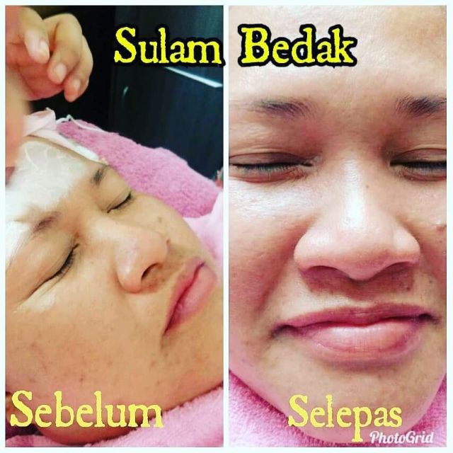 Sulam Bedak Tanam Foundation Bb Glow Korea Trend 5ml Shopee Malaysia