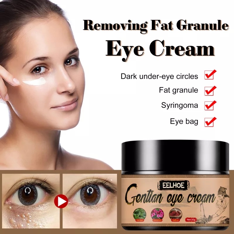 Krim mata Biji kolestrol bawah mata Milia seed Eye bag Dark circle ...