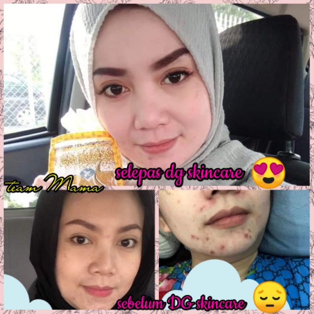 DIAMOND GOLD SKINCARE  Shopee Malaysia