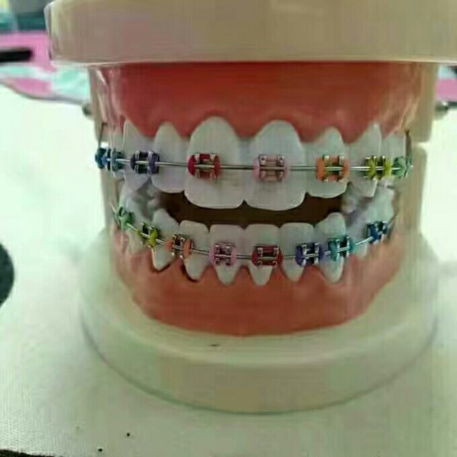 Buy Fake Braces Click by Sue  SeeTracker Malaysia