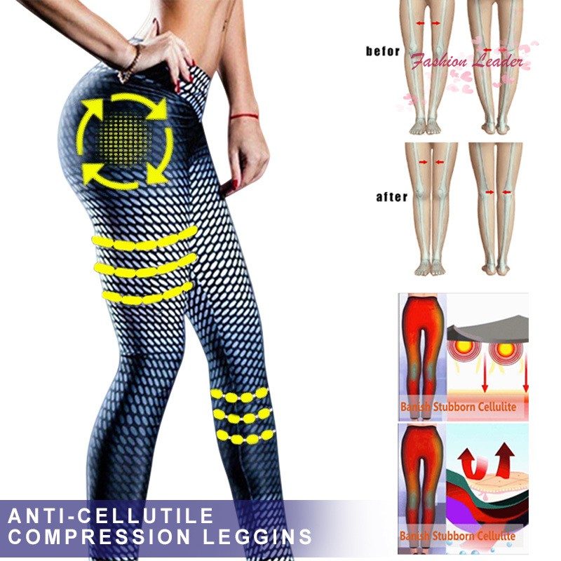 anti compression cellulite leggings