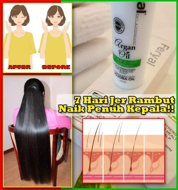 Cara Nak Tumbuhkan Rambut