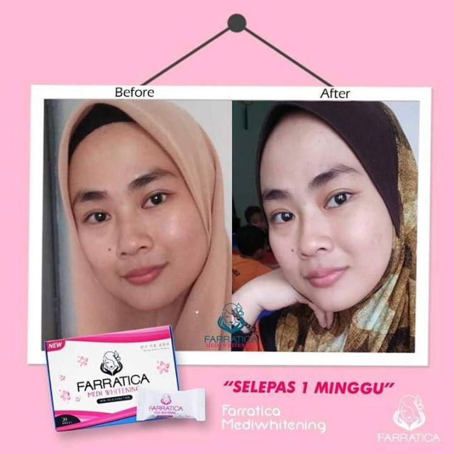 Buy Farratica Medi Whitening Seetracker Malaysia