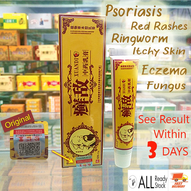 Psoriasis Eczema Cream Antifungal Antibacterial Itchy Cream Ubat Gatal ...