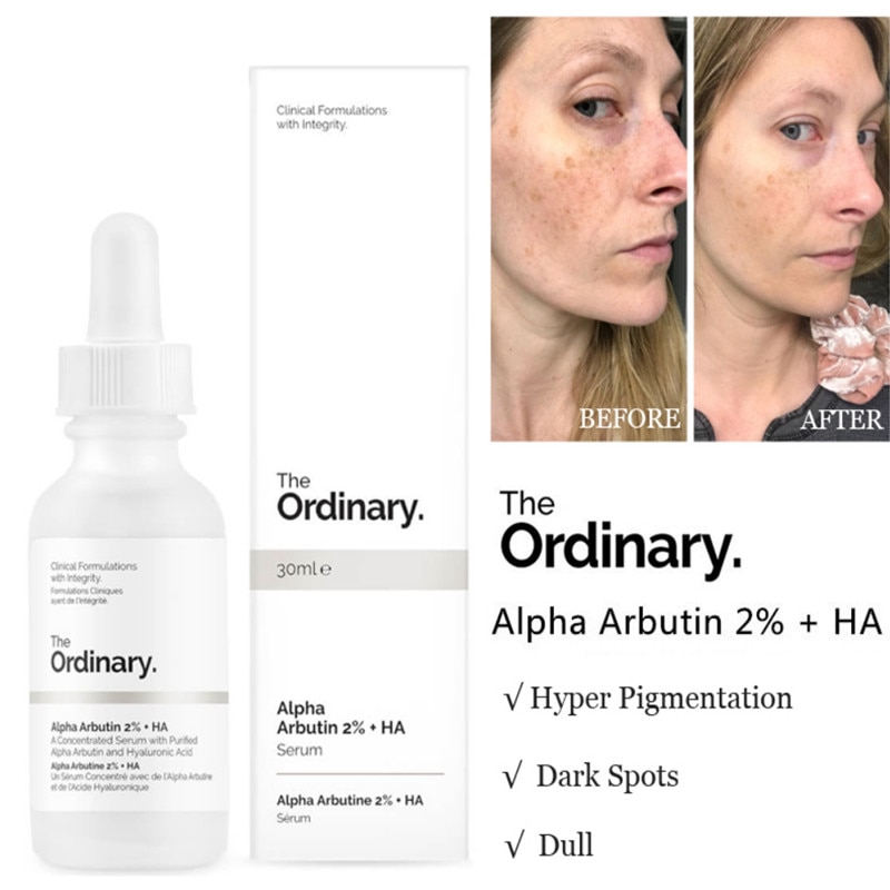 face serum the ordinary