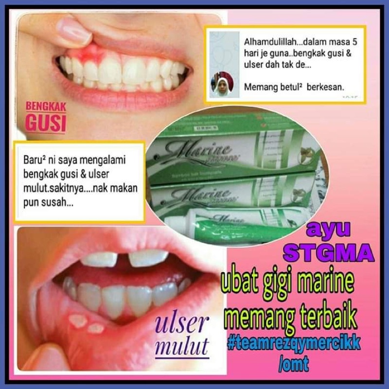 Ready Stok Ulser Gusi Bengkak Sakit Gg Plak Marine Essence Toothpaste Shopee Malaysia