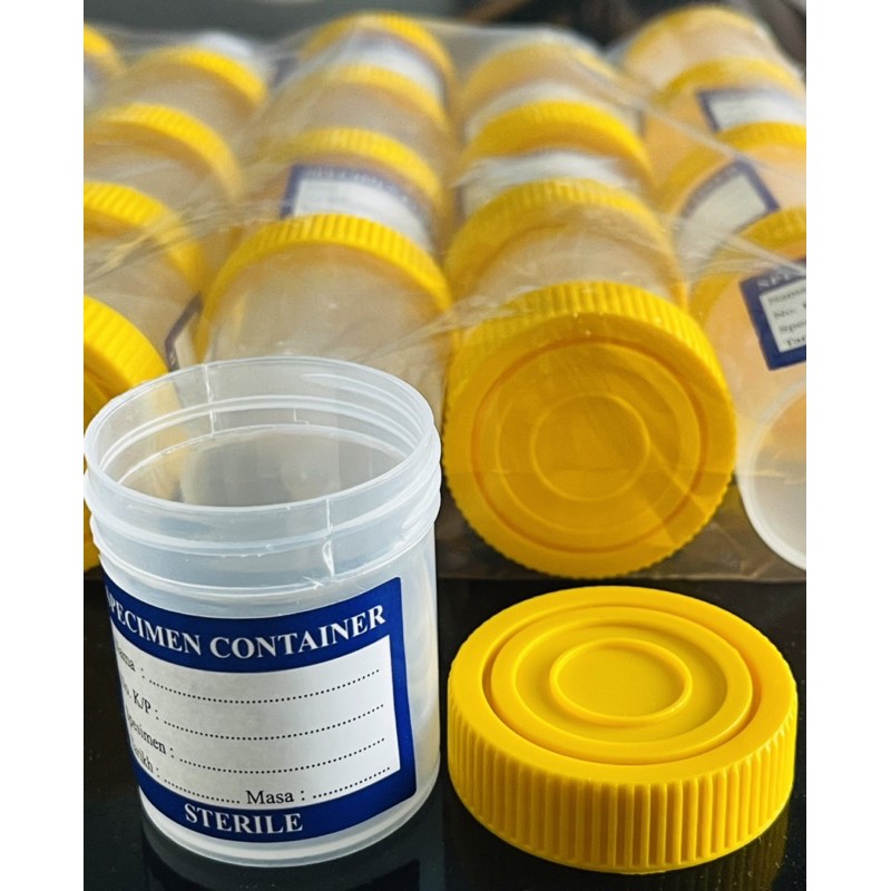 Urine Specimen Container With Yellow Screw Cap With Label 60ml