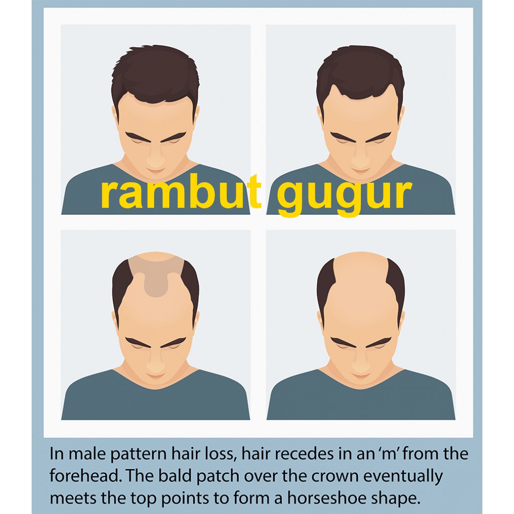  Vitamin RAMBUT GUGUR  untuk kuatkan rambut  Lebatkan 