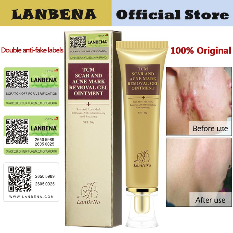 【Ready Stock】LANBENA Original Acne Scar Removal Cream Skin Repair Face