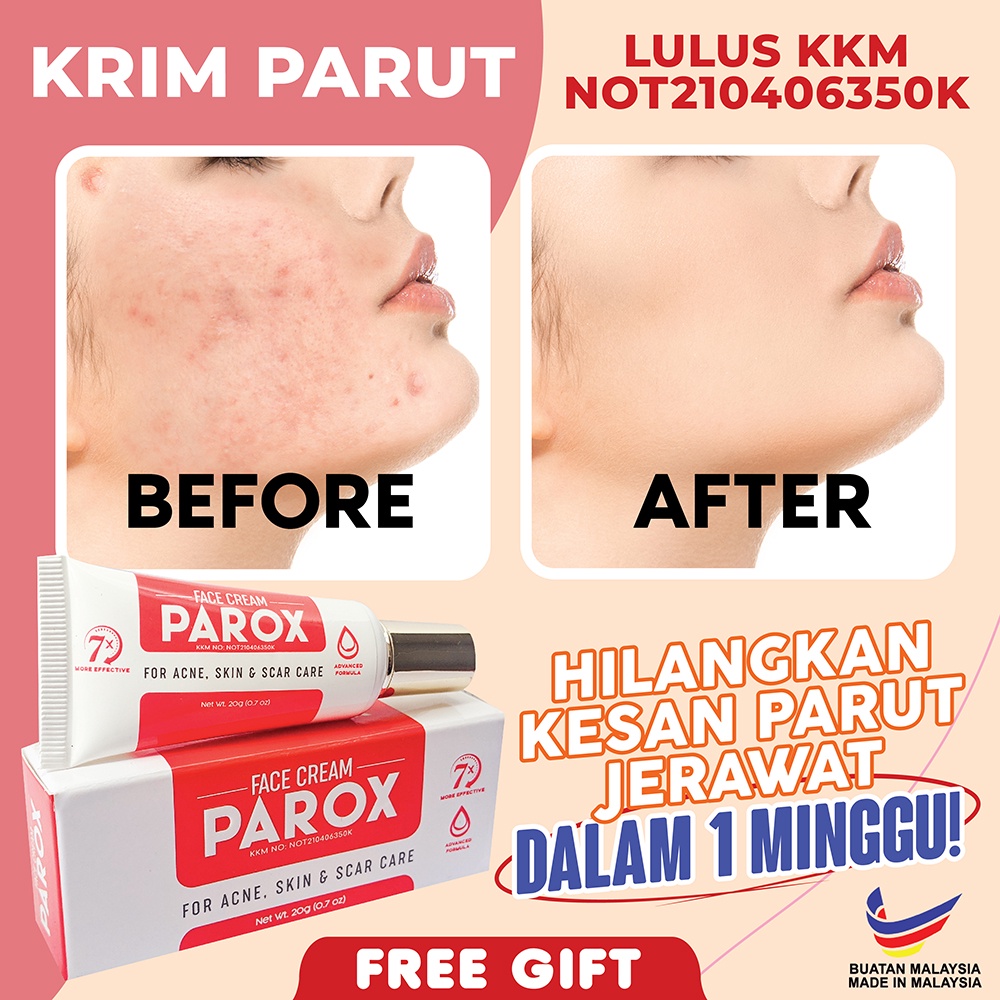 Scar Cream Parox Ubat Parut Lulus Kkm Face Cream Parox Scar Cream Ubat Parut Kudis Krim Kilinik Rawat Jerawat Shopee Malaysia