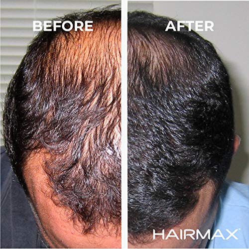 HairMax Laser Hair Growth Band LaserBand 82 (FDA Cleared). | Shopee Malaysia