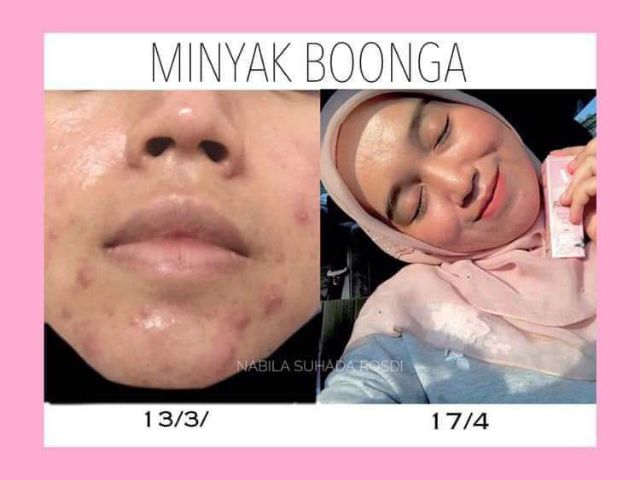 Produk Hot Minyak Boonga Shopee Malaysia