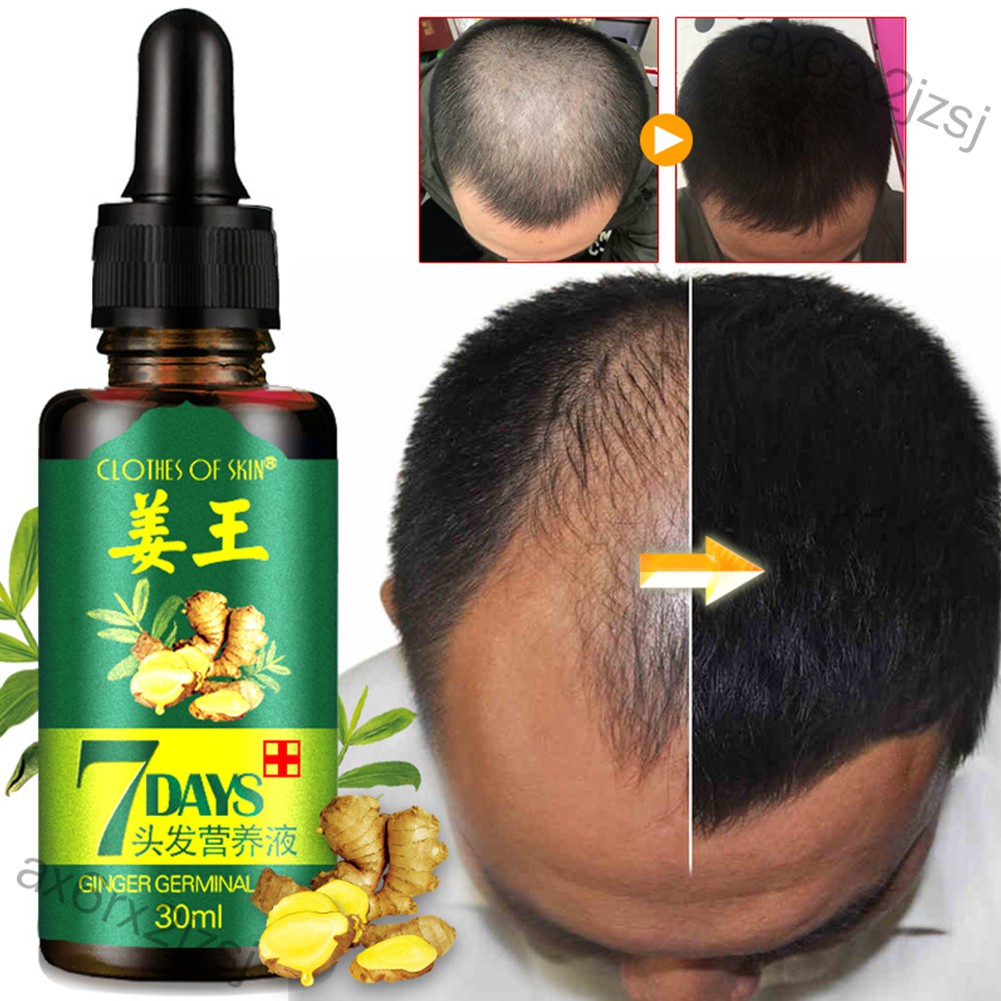 ax6rx2jzsj 30ml Women Men Hair Care Growth Essence Liquid Fast Restoration Hair Hair Loss Nutrition Tool