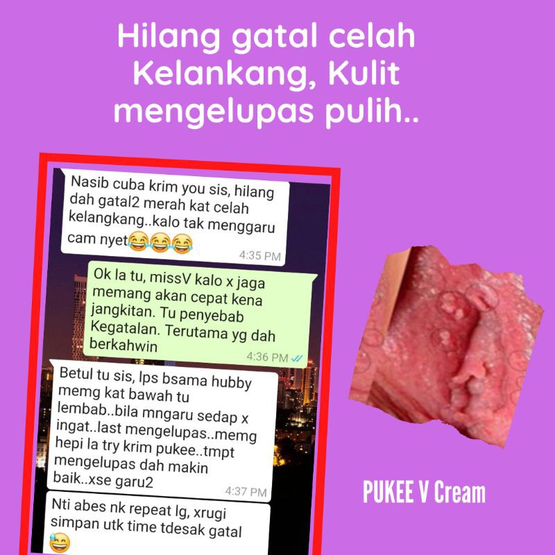 Buy Ubat Gatal Celah Peha Berkesan Hilang Gatal Keputihan Rawat Keputihan Gatal Kemaluan Miss V Berair Gatal Seetracker Malaysia