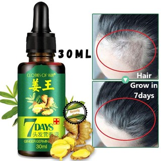 🔥ON SALE🔥 Ginger King Hair Growth Serum 7 Days Essence + Shampoo Halia ...