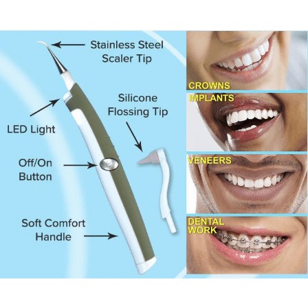 Alat Pembersih Gigi Electric Type Teeth Cleaner Alat Bersih Karang Gigi Alat Bersih Bracers Gigi Teeth Scaling Tools Shopee Malaysia