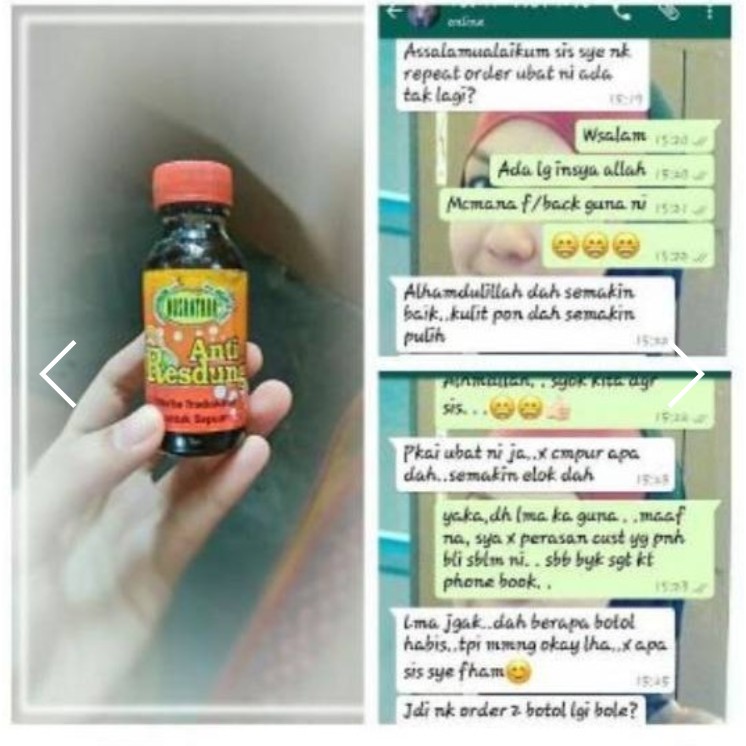 Hot Hot Sale Anti Resdung Ubat Resdung Gamat Nusantara Langkawi Shopee Malaysia