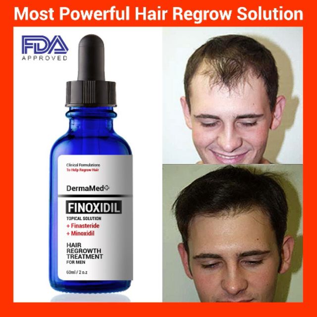 buy liquid finasteride